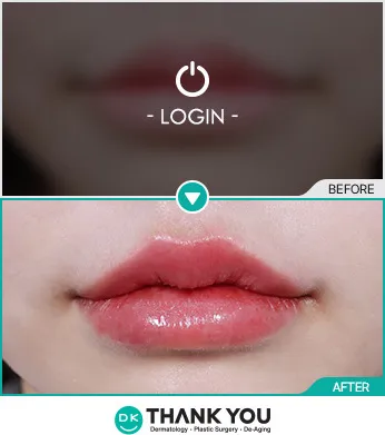 Before/After