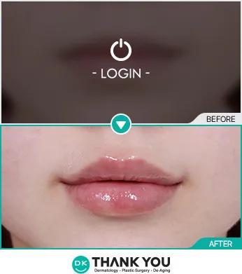 Before/After