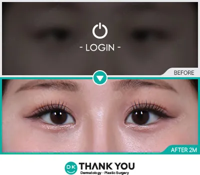 Before/After