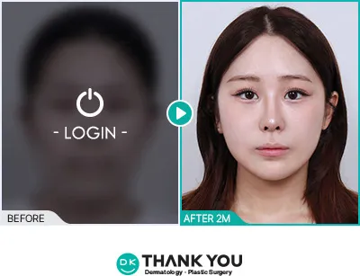 Before/After
