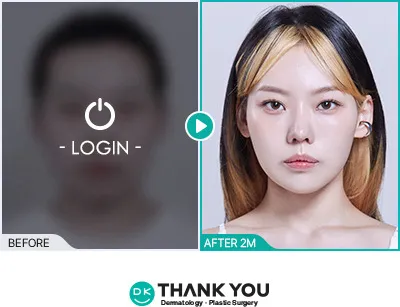 Before/After