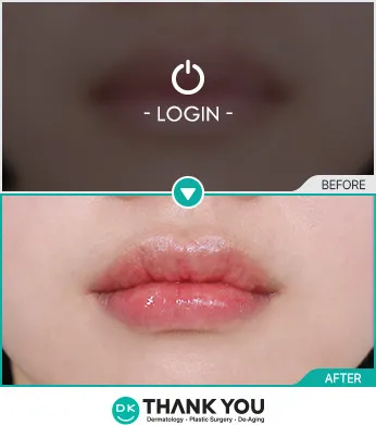 Before/After