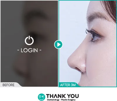 Before/After