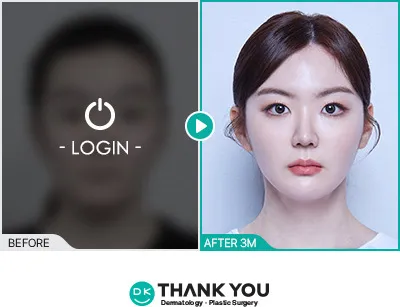 Before/After