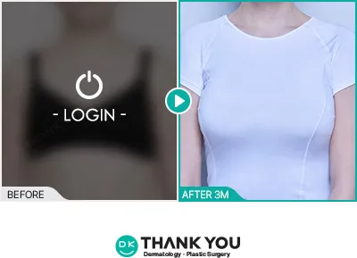 Before/After