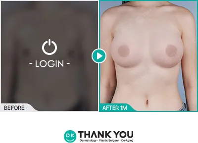 Before/After