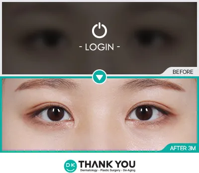 Before/After