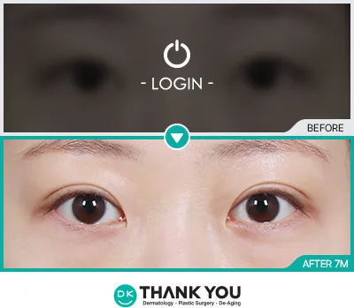 Before/After