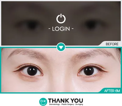 Before/After