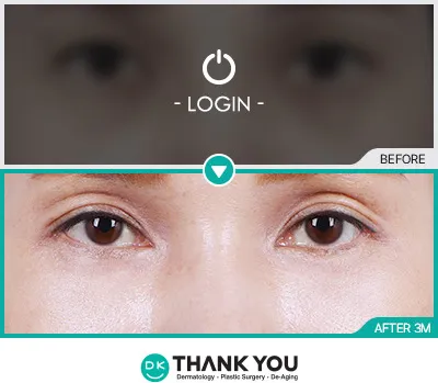 Before/After