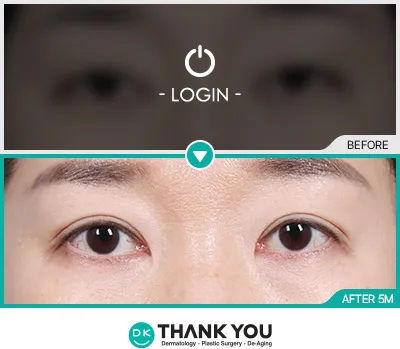 Before/After
