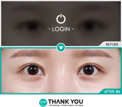 Before/After