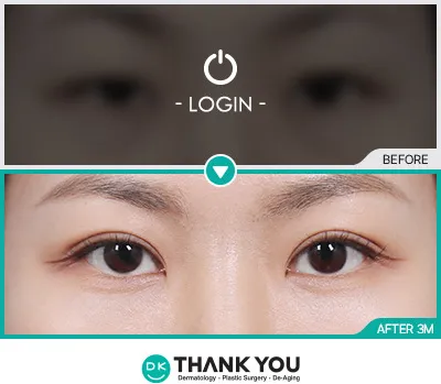 Before/After