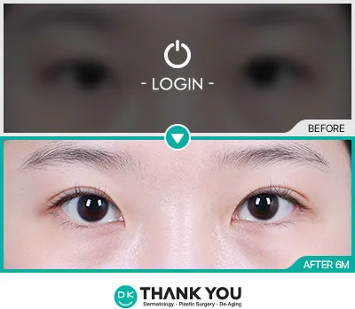 Before/After