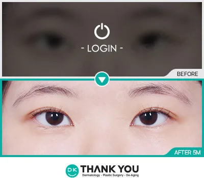 Before/After