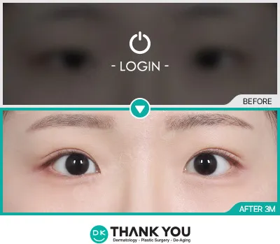 Before/After