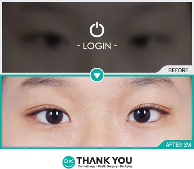 Before/After