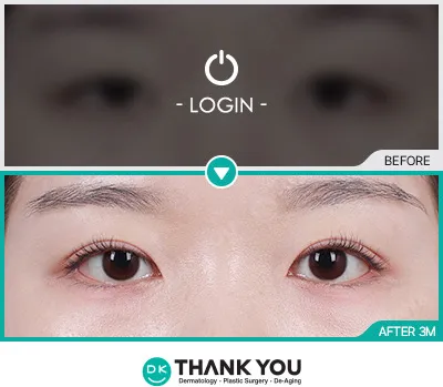 Before/After