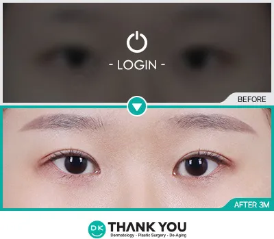Before/After