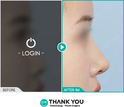 Before/After
