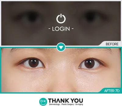 Before/After