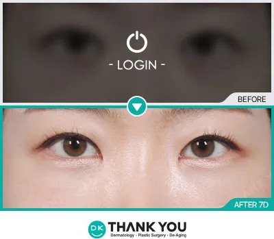 Before & After