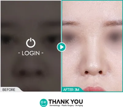 Before/After