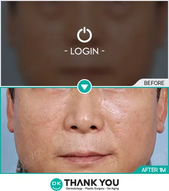 Before/After