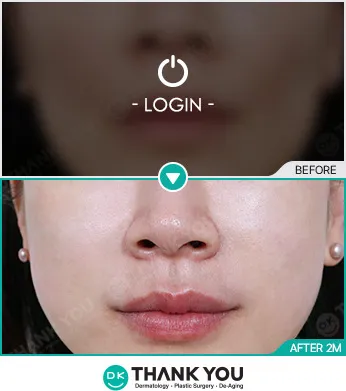 Before/After