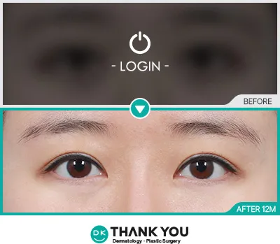 Before/After