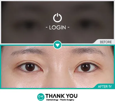 Before/After