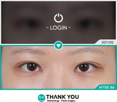 Before & After