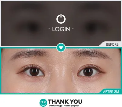 Before/After