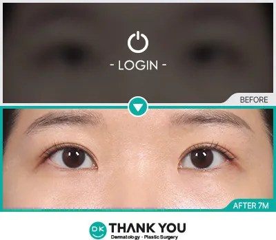 Before/After