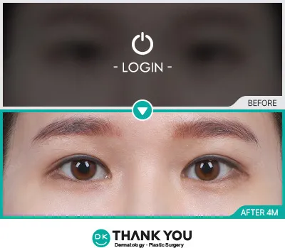 Before/After