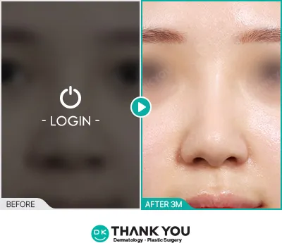 Before/After