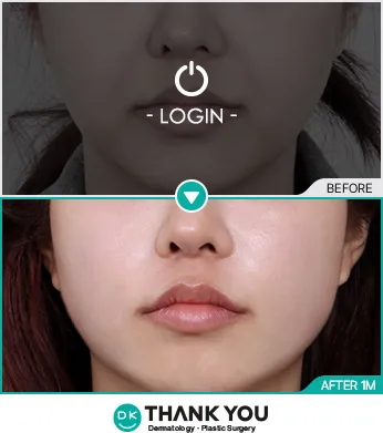 Before/After