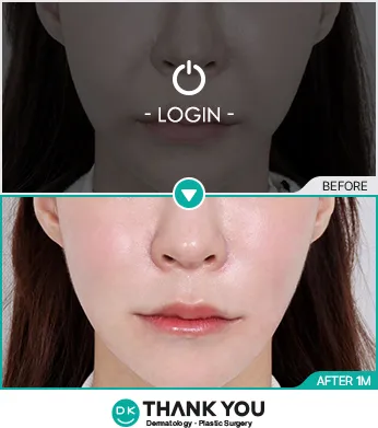 Before/After