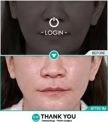 Before/After