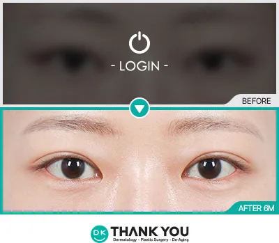 Before/After