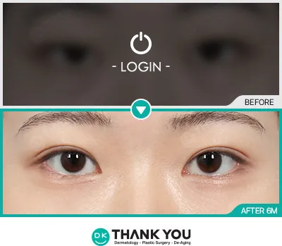 Before/After