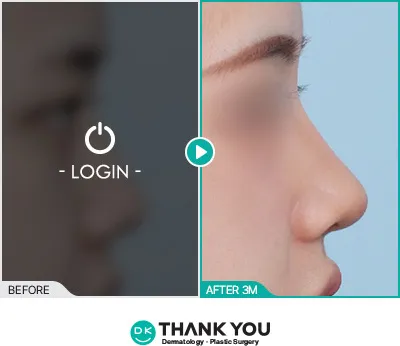 Before/After