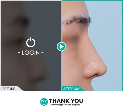 Before/After