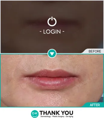 Before/After