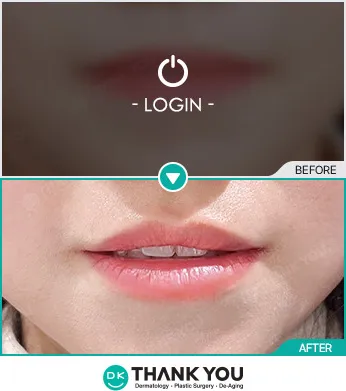 Before/After