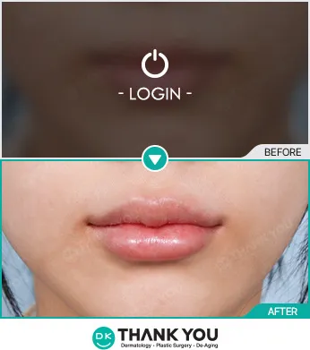 Before/After