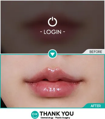 Before/After