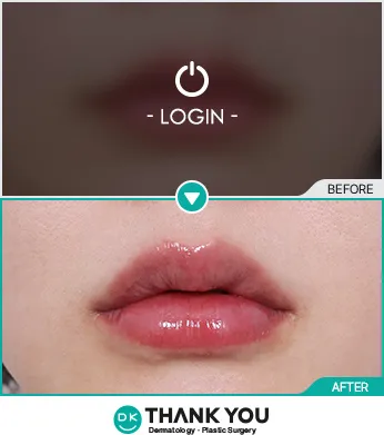 Before/After