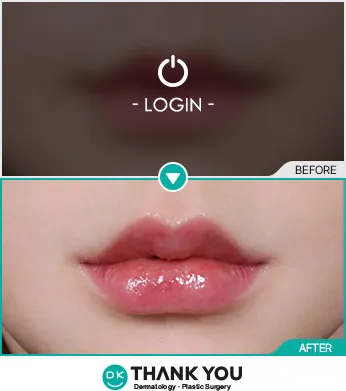 Before/After