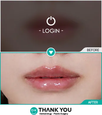 Before/After